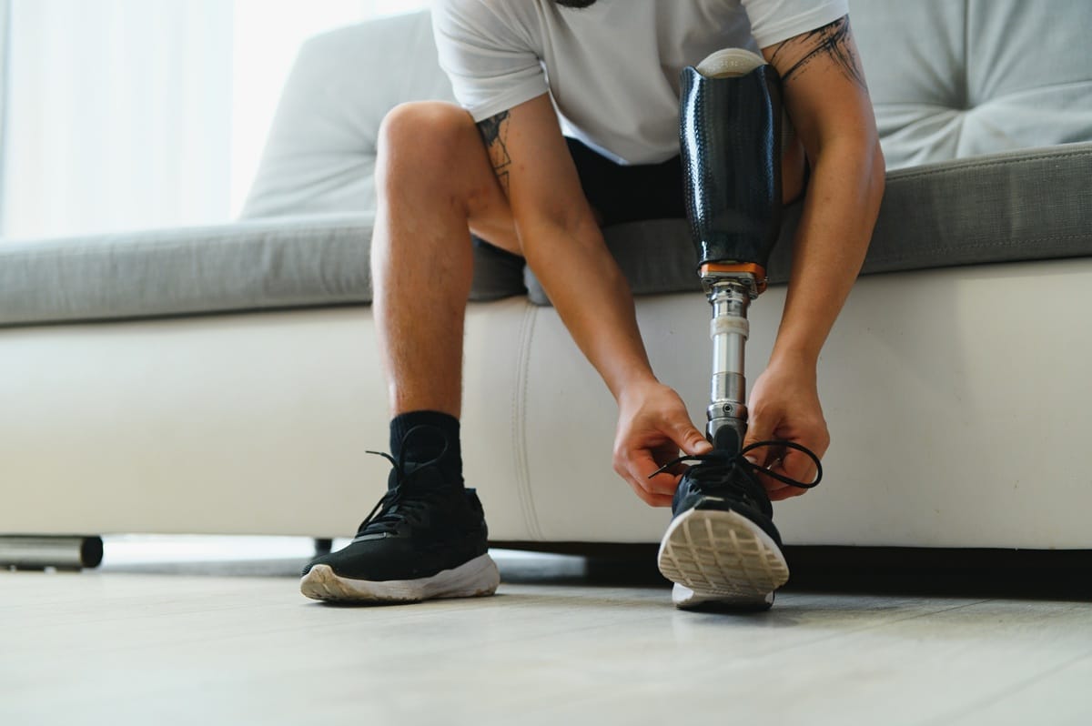 Limb-differences-or-amputations